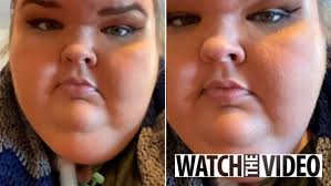 1000-Lb Sisters star Tammy Slaton shows off unfiltered face in new video as  she's 'improving' in rehab for weight loss