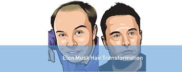 Infused with sunflower extract and jojoba oil to replenish and seal in moisture to protect against hair breakage. Elon Musk Hair Loss And Recovery Story Transformation