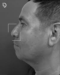 Dr David Lurduy Cirugía Plástica