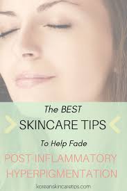 228 likes · 17 were here. How To Get Rid Of Post Inflammatory Hyperpigmentation Aka Acne Marks Post Inflammatory Hyperpigmentation Inflammatory Hyperpigmentation Hyperpigmentation