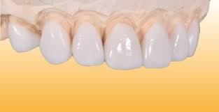 We apologize for the inconvenience this may cause and hope for your understanding in this matter. Services Dentist Ozan Guner For A Better Smile