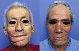 EDITORIAL ORIGINAL ARTICLES REVIEW ARTICLES CLINICAL CASES