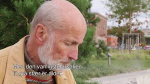 Behandlingen for grå stær er operasjon hvor øyets linse blir erstattet av en kunstig linse. Bli Med Inn I Oyet Gra Staer Katarakt Youtube