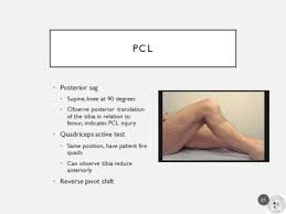Image result for PCL Sag Test