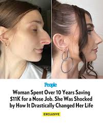 I agree that she didn't need the nose job but what was that extra details  😭😭😭