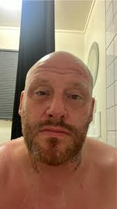 What ideas can help with hair loss?