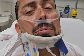 Fundraiser by Ed Cabrera : Ed Cabrera Needs Your Help to Heal