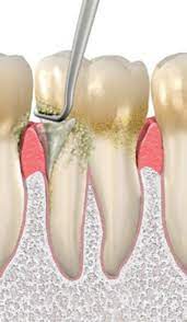 Dentaltown Where The Dental Community Lives Dental Dentistry Dental Hygiene School