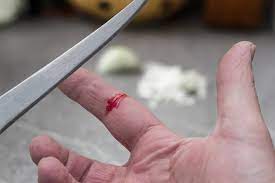 So versorgen sie schnittwunden richtig! Eine Schnittwunde Richtig Behandeln I Docsonnet