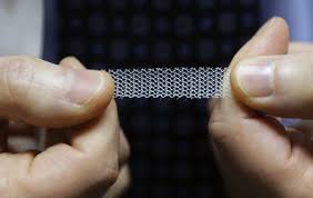Pelvic Mesh Is Under Fire What Should Women With Prolapsed Organs Do