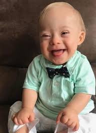 Singurul portal de stiri dedicat sectorului nonprofit. Bebe Lucas Afectat De Sindromul Down Imaginea Unei MÄrci De HranÄ Pentru Nou NÄscuÈi Europa Fm