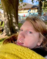 With the heaviest of hearts, we share the passing of our CASK community's  beautiful Skye MacLeod. Skye's mother Kirsty shared how their hearts were  shattered