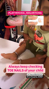 Image result for Koilonychia feet