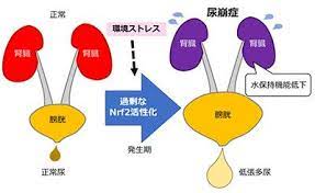 腎臓発生期におけるnrf2の過剰な活性化が腎性尿崩症を引き起こす 東北大 マイナビニュース 尿崩症 活性 腎臓
