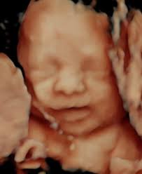 Babys Bungalow 3D/4D & HD-Live Ultrasound