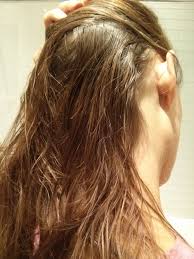 Waxy Greasy Hair After Shower A Surprising Form Of Dermatitis Greasy Hair Hairstyles Greasy Hair Remedies Natural Hair Conditioner
