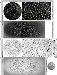3 punkte für georgfriedrich bild 10,ein pinkfarbener koffer auf reisen, erinnert mich an den film die fabelhafte welt der amelie. In Vivo Dynamics Of Retinal Microglial Activation During Neurodegeneration Confocal Ophthalmoscopic Imaging And Cell Morphometry In Mouse Glaucoma Protocol Translated To German
