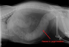 Image result for Acute Constipation