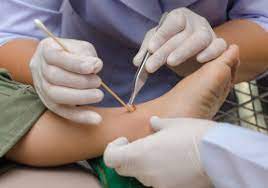 Hautchirurgie Chirurgie Am Stachus