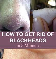 Blackheads Are Extremely Common But Can Be Removed Easily And Painlessly With A Little Know How Find Get Rid Of Blackheads Blackheads Moisturizing Face Cream