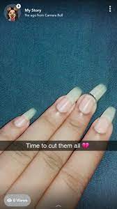 Naturalnails Brokennails Snap Chat Ashini Cm Broken Nails Natural Nails Snapchat