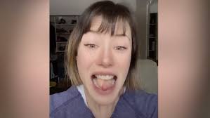 Woman Whose Tongue Was Partially Replaced by Thigh Due to...