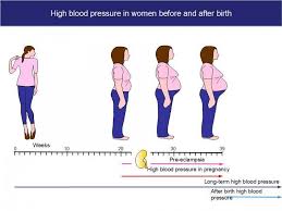 However, premature detachment of the placenta cannot be prevented or anticipated. Having High Blood Pressure In Pregnancy Can Be Very Serious It Is Important That You Go To The Antenatal Clinic Regularly During Your Pregnancy So That Your Blood Pressure Can Be Checked