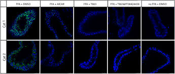 Un centimetru, de câte ori este mai mic decât un metru aria este mărimea fizică care are ca unitate de măsură in sistemul internațional Identification Of Potential Drugs For Treatment Of Hepatic Lipidosis In Cats Using An In Vitro Feline Liver Organoid System Haaker 2020 Journal Of Veterinary Internal Medicine Wiley Online Library