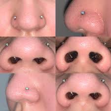 Should I Retire The Nose Piercing On The Right Of The Pictures Piercer Told Me The Angle It Was Done At Is Why A Bump I Ve Had Since January Hasn T Gone Away