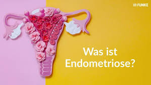 Learn about pms or premenstrual syndrome. Pramenstruelles Syndrom Das Sind Die 20 Haufigsten Pms Symptome Bildderfrau De