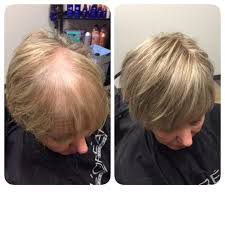 These styles allow you to use styling tricks to make your. Hair Extensions For Thin Hair On Top