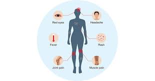 Its name comes from the ziika forest of uganda, where the virus was first isolated in 1947. Zika Virus Zikv Overview Structure Symptoms Transmission Diagnosis Etc Cusabio