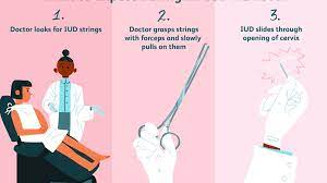 We did not find results for: What To Expect During Your Iud Removal