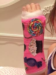 One of our favorites is super easy and creative. 80 Cast Decorating Ideas It Cast Cast Decoration Arm Cast