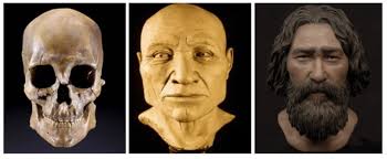 Malocclusion in ancient times exists