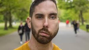 Poole: 'My toddler was told his face looked terrifying'