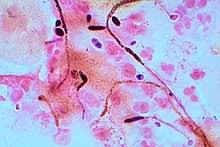 14th century, in the meaning defined at transitive sense 1. Gram Stain Wikipedia