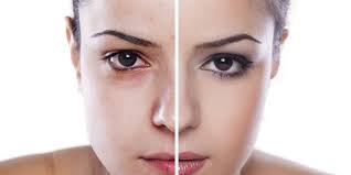 So erholt sich ihr körper nach der letzten zigarette: Vorher Nachher Fotos Raucher Sehen 5 Jahre Alter Aus Desired De