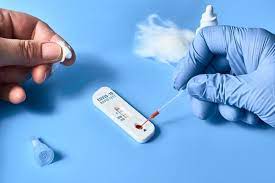 Namun, ada kekurangan pada rapid test ini, yaitu tingkat sensitivitas hanya. Interpretasi Hasil Rapid Test Igg Dan Igm Untuk Covid 19 Alomedika