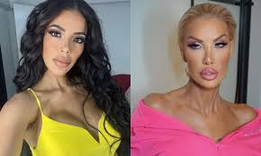Jasmine Before And After 😳 : R/90Dayfiance