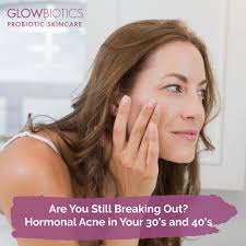 What causes monthly hormonal acne around the time of your period? Acne In 30s 40 S Dealing With Adult Hormonal Acne