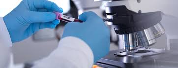 Psa levels increase with age and may be higher in men with a common, noncancerous condition called benign prostatic hyperplasia, or another condition called prostatitis. Prostate Specific Antigen Psa Blood Test