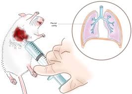 Image result for Intrapleural Anesthesia