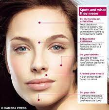 Maybe you would like to learn more about one of these? How Stress Affects The Skin Positivemed How To Get Rid Of Acne Acne Treatment Face Mapping Acne