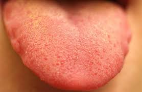 In the third world it is best to use the kinds of pesticides (i.e. How Would You Know If You Have Cancer