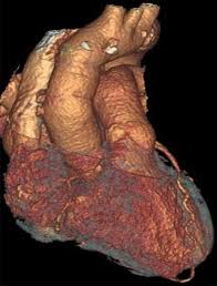 Image result for Pseudoeriosema