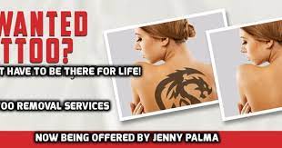 Laser Tattoo Removal Services By Jenny Palma In Toronto And The Gta Is The Destination For High Quality Laser Tattoo Removal Tattoo Removal Tattoo Removal Cost