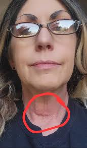 The Centers for Advanced Orthopaedics, Mid-Maryland Musculoskeletal  Institute