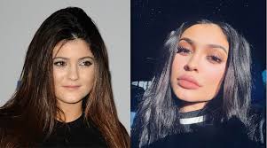 And these kylie jenner's plastic surgery before and after photos to conclude the reasonable. Kylie Jenner Opens Up About Plastic Surgery And Reveals The Real Reason She Gets Lip Fillers Celebrity Heat