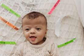 Fundraiser by Candice Lofton : Judah the Lion Takes On Cranio